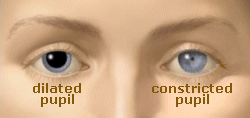 This is a good guide for recognizing dilated vs. constricted pupils.