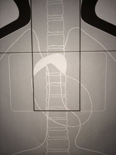 On the F-TQ19ANT-MCSD target the heart, lungs, and spinal cord are highlighted within a white rectangular box, with a smaller black square for optimum hits. 